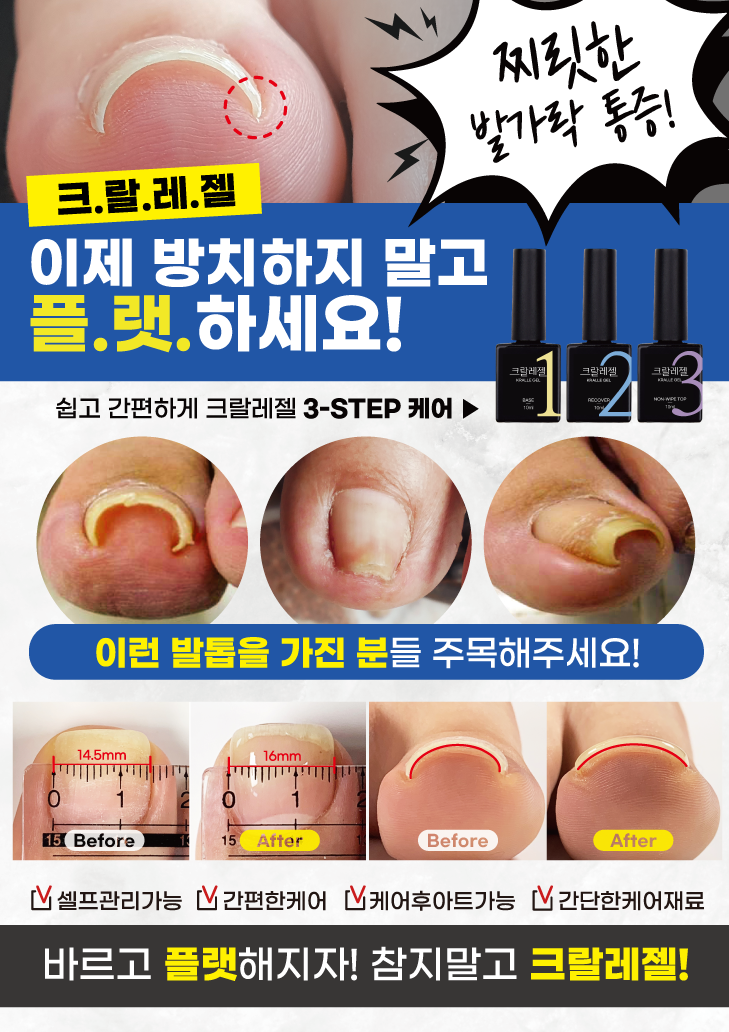 Kralle Gel - produse pentru unghia încarnată ( CURS inclus )